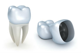 Dr. Kureghian | Northridge, CA Dentist | Porcelain Veneers