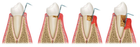 Dr. Kureghian | Northridge, CA Dentist | Gum Disease Treatment