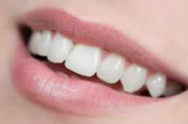 Dr. Kureghian | Northridge, CA Dentist | Composite (White) Fillings